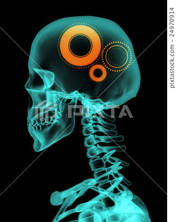 Xray of skull with gears. 24970914