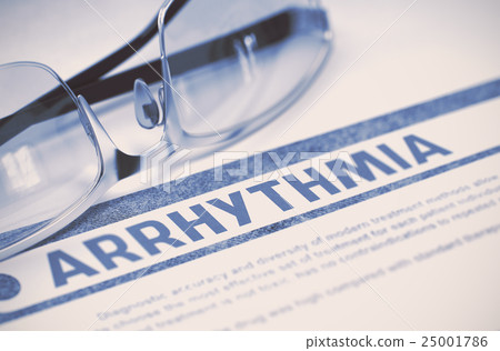 Arrhythmia. Medicine. 3D Illustration. 25001786