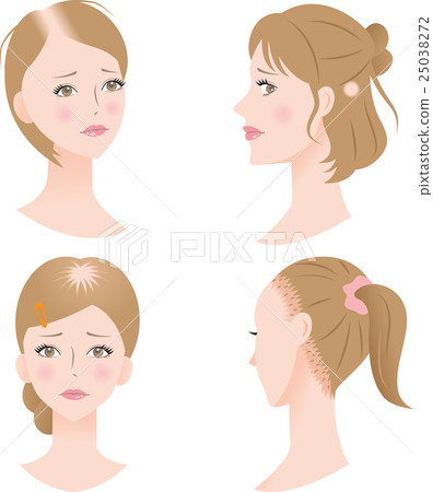 Baldness trouble women 25038272