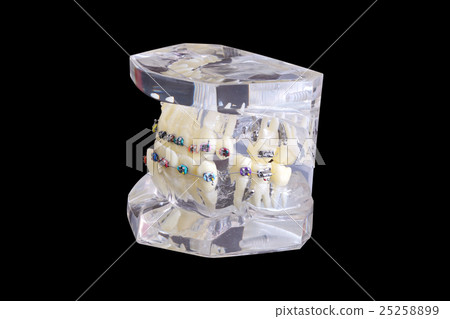 Model of human jaw with wire braces attached 25258899
