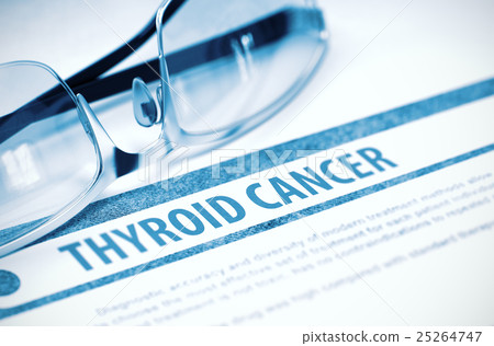 Thyroid Cancer. Medicine. 3D Illustration. 25264747