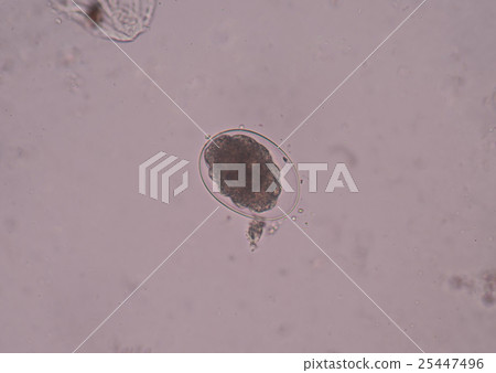 Hookworm is a parasitic nematode that Hookworm is a parasitic nematode that 25447496