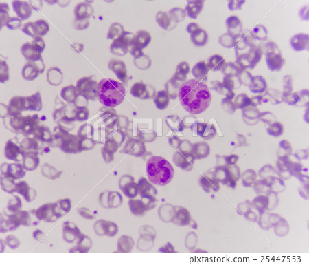 Neutrophil cell (white blood cell) 25447553