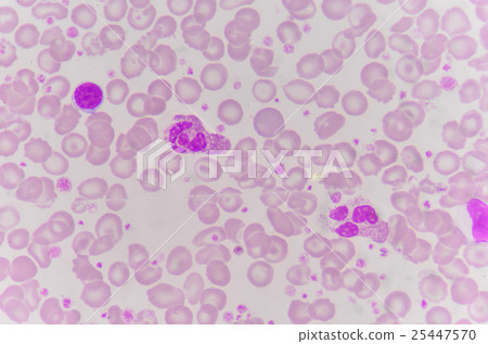 red blood cells with white blood cells background. 25447570