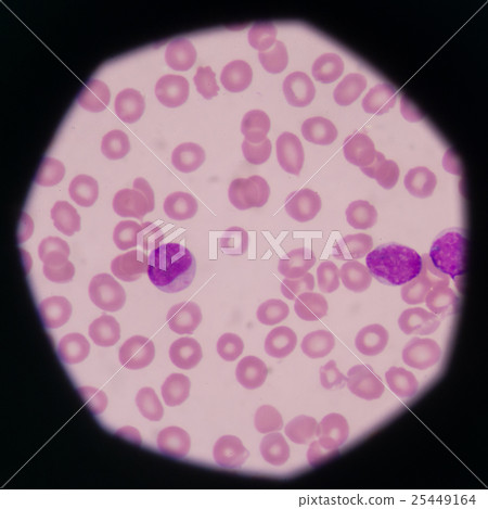 blast cells in peripheral blood images. 25449164