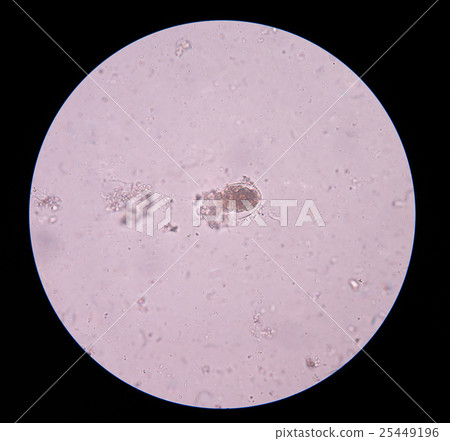 Egg parasite. Egg parasite. 25449196