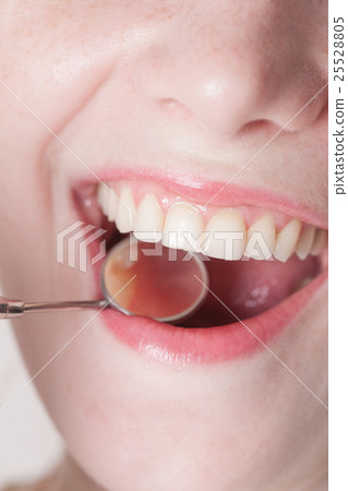 Check the teeth 25528805