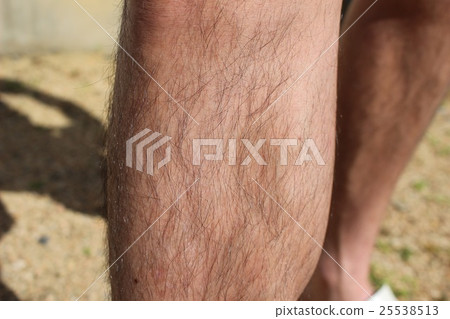 Dead waste and muscles of the foot Dead waste and muscles of the foot 25538513