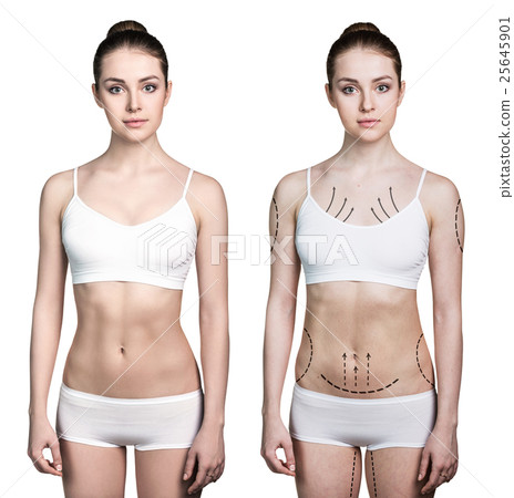 Woman before and after lose weight Woman before and after lose weight 25645901