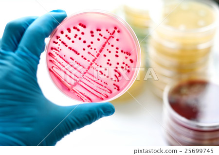Colonies of bacteria in MacConkey agar Colonies of bacteria in MacConkey agar 25699745