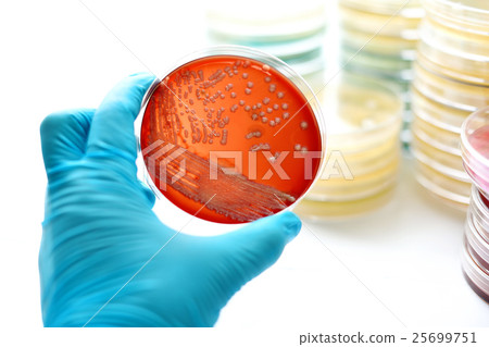 Colonies of bacteria in blood agar  25699751