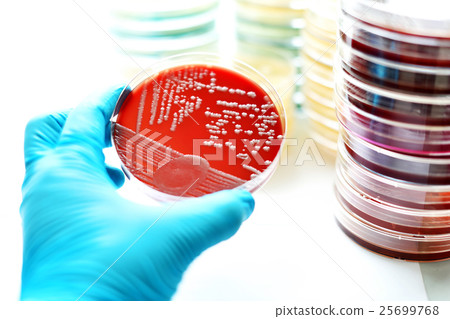 Bacteria culture in petri dish 25699768