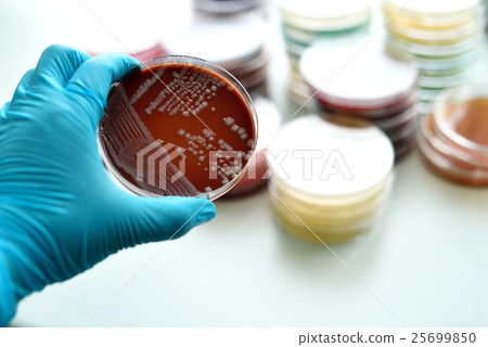 Colonies of bacteria in chocolate agar  25699850