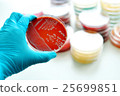 Colonies of bacteria in blood agar  25699851