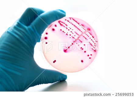 Bacteria culture in petri dish 25699853