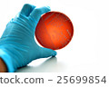 Colonies of bacteria in blood agar  25699854