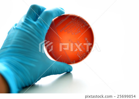 Colonies of bacteria in blood agar  25699854
