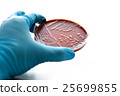Colonies of bacteria in chocolate agar  25699855