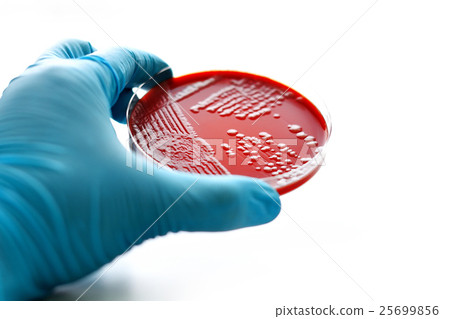 Colonies of bacteria in blood agar Colonies of bacteria in blood agar 25699856