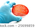 Colonies of bacteria in blood agar  25699859
