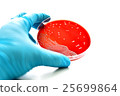 Colonies of bacteria in blood agar  25699864