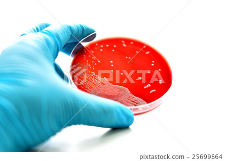 Colonies of bacteria in blood agar Colonies of bacteria in blood agar 25699864