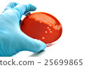 Colonies of bacteria in blood agar  25699865