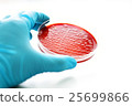 Colonies of bacteria in blood agar  25699866