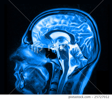 Magnetic resonance imaging of the brain Magnetic resonance imaging of the brain 25727012