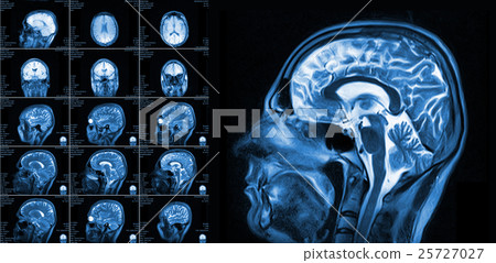 Magnetic resonance imaging of the brain Magnetic resonance imaging of the brain 25727027
