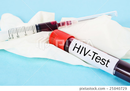 Sample blood for screening test for HIV test. 25840729