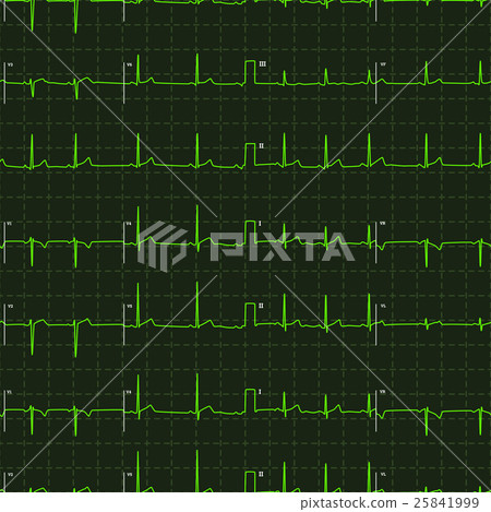 electrocardiogram green graph on dark 25841999