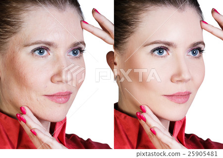 Woman before and after cosmetic procedure Woman before and after cosmetic procedure 25905481