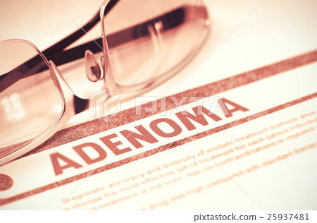 Diagnosis - Adenoma. Medicine Concept. 3D 25937481