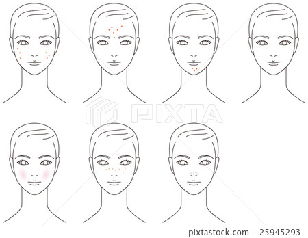 Facial skin problems acne female Facial skin problems acne female 25945293