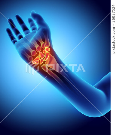 3D illustration of Carpal, medical concept. 26057524