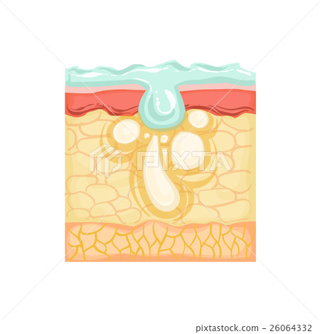 Dermatology Skincare Anatomical Info Illustration 26064332