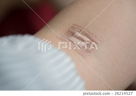 Blood sampling 26214527