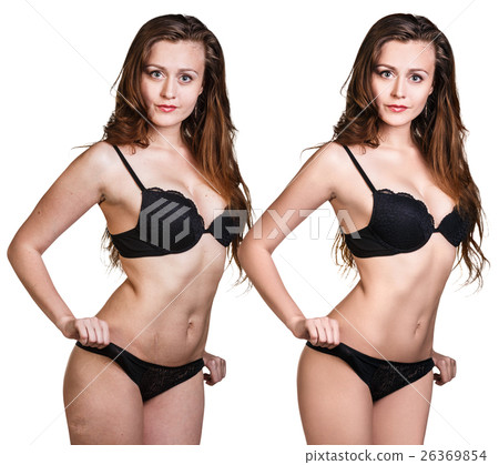 Woman body before and after retouch. Woman body before and after retouch. 26369854