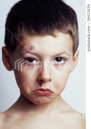 Little boy whipped close up Little boy whipped close up 26411634