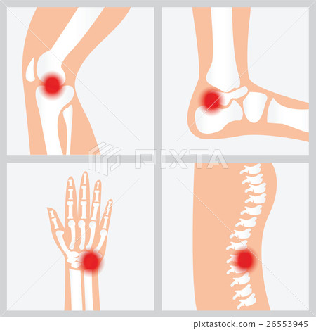 Disease of the joints and bones. Disease of the joints and bones. 26553945
