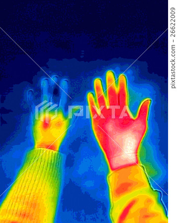 Image of thermography Image of thermography 26622009