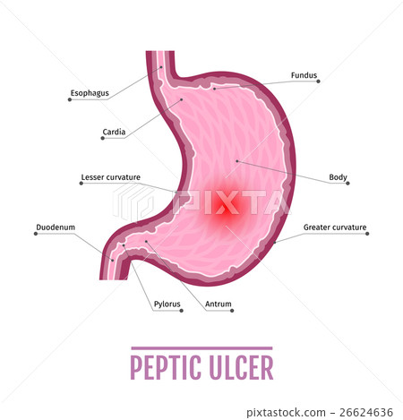 medical illustration of the human stomach with medical illustration of the human stomach with 26624636