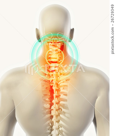 Neck painful - cervica spine, 3D illustration. Neck painful - cervica spine, 3D illustration. 26729349