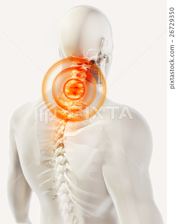 Neck painful skeleton x-ray, 3D illustration. Neck painful skeleton x-ray, 3D illustration. 26729350