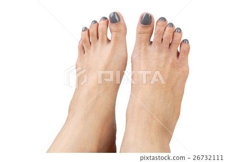 female feet with eczema infect, isolated on white female feet with eczema infect, isolated on white 26732111