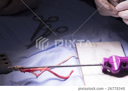 Knee tendon ligament surgery Knee tendon ligament surgery 26778348