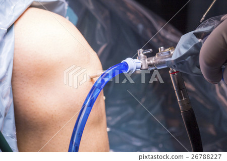 Surgical operation knee surgery Surgical operation knee surgery 26788227