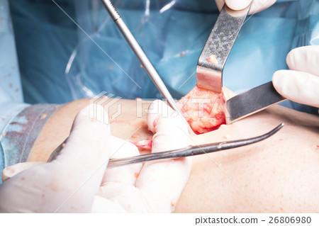 Surgical operation knee surgery Surgical operation knee surgery 26806980