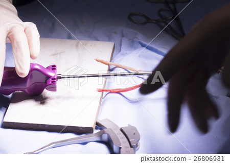 Knee tendon ligament surgery Knee tendon ligament surgery 26806981